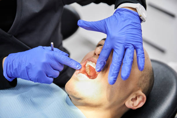 Best Emergency Wisdom Tooth Extraction in Williams, OR